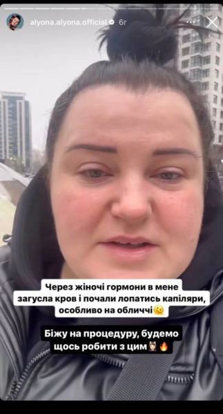 alyona alyona відверто розповіла про проблеми зі здоров'ям і показала, як робить процедури краси