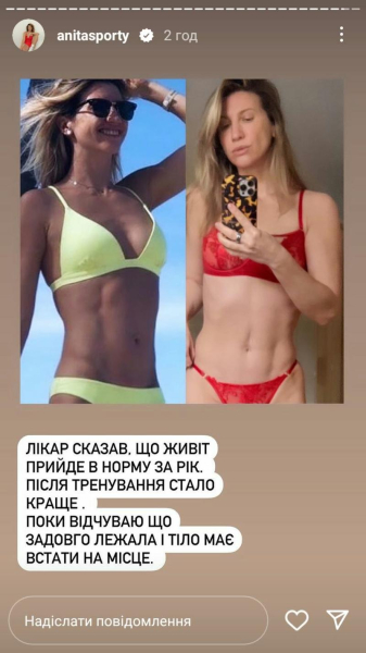 Аніта Луценко зробила пластику після невдалої операції на животі