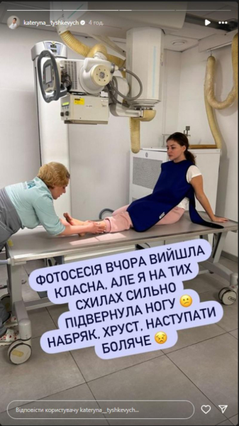 Катерина Тишкевич знову опинилась у лікарні: акторка повідомила про травму