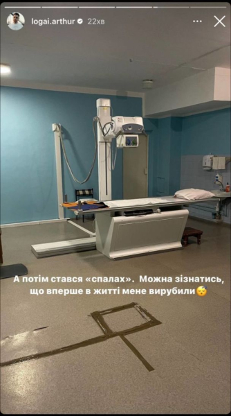 Відомий український актор потрапив до лікарні зі струсом мозку: "Вперше в житті мене вирубили"