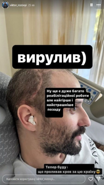 Зірка "Ліги Сміху" Розовий вперше показав, який вигляд має після тяжкого поранення голови на фронті