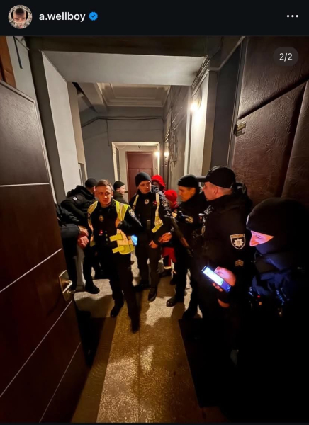 Відомий український співак Wellboy шокував, що його побили, і показав серйозні травми на голові